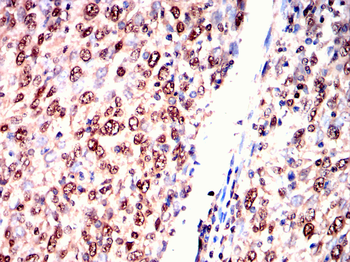 PSMC2 Antibody