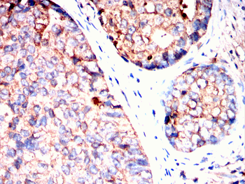 PFKP Antibody