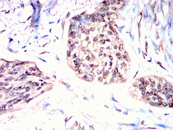 RAD23B Antibody