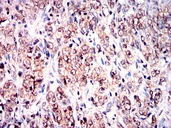 ATG4D Antibody