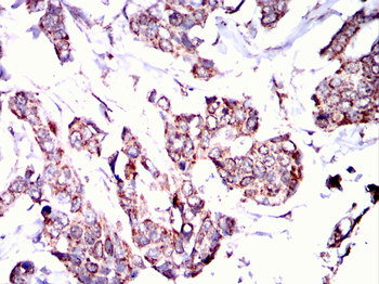 RPS6KB2 Antibody