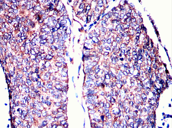 RPS6KB2 Antibody