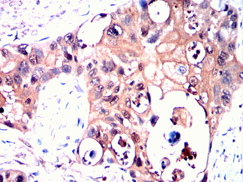SERPINB3 Antibody