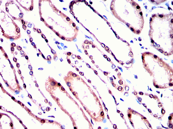 IKBKG Antibody