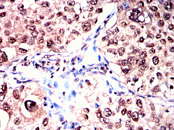 IKBKG Antibody