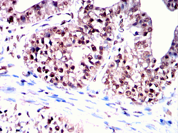 IKBKG Antibody