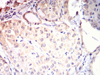 PRKAB1 Antibody