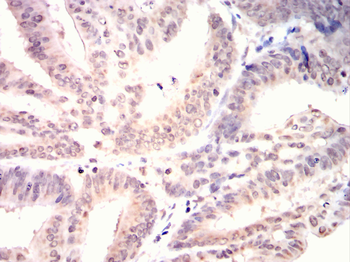 CDCA8 Antibody