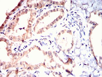 CDCA8 Antibody