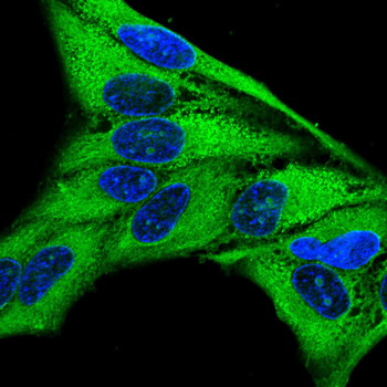 USP14 Antibody