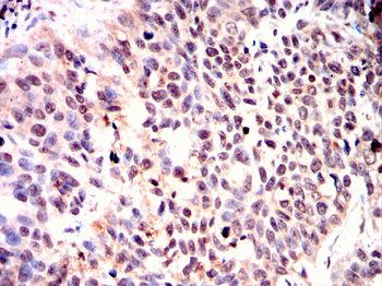 STRA8 Antibody