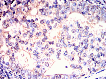 STRA8 Antibody