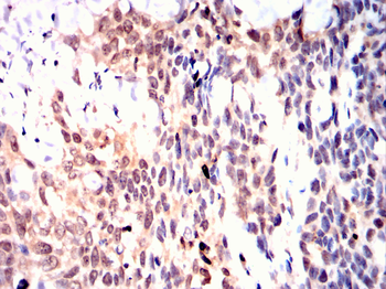 RUVBL1 Antibody