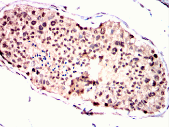 RUVBL1 Antibody
