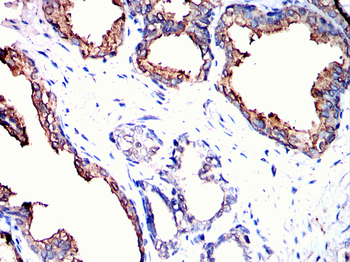 KLK2 Antibody