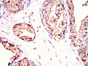 KLK2 Antibody