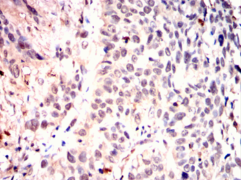 AKT2 Antibody