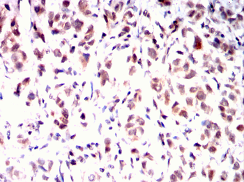 XBP1 Antibody