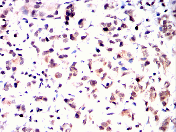 STAT5B Antibody