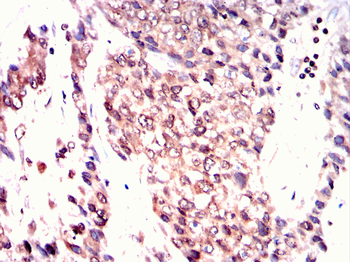 STAT5B Antibody