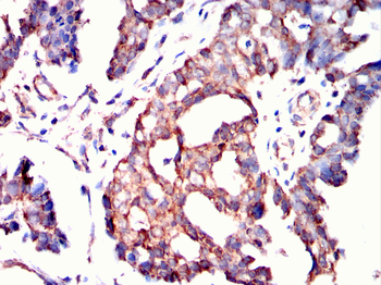 ETFA Antibody