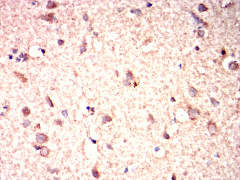 CTCF Antibody