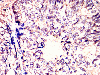 CTCF Antibody