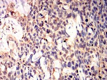 MAP2K4 Antibody
