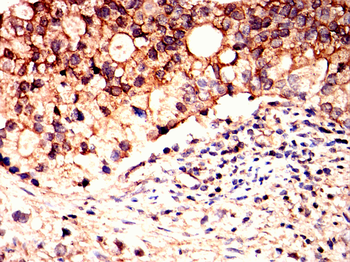 MAP2K4 Antibody