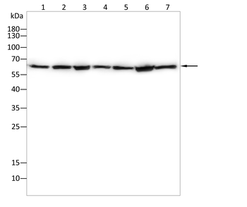HSP60 Rabbit Polyclonal Antibody