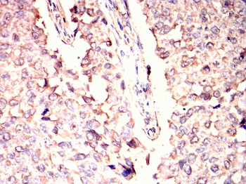 GRK2 Antibody