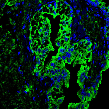 GRK2 Antibody