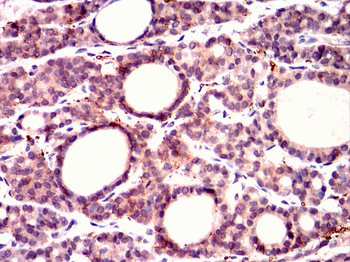PDK1 Antibody