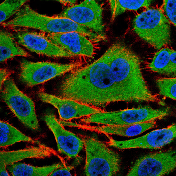 PDK1 Antibody