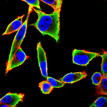 LDLR Antibody