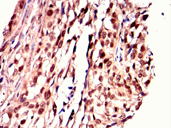 LDLR Antibody