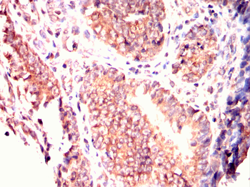 CHEK1 Antibody