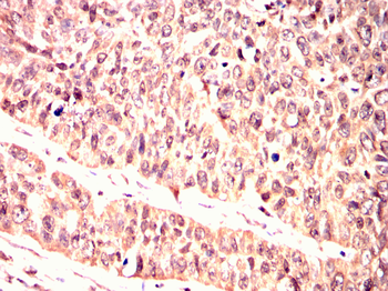 CHEK1 Antibody
