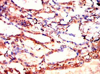 CHEK1 Antibody