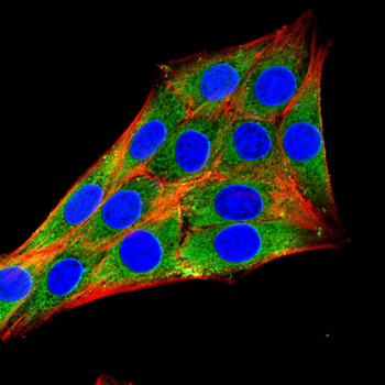 GKAP Rabbit Polyclonal Antibody