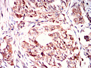 MCM2 Antibody