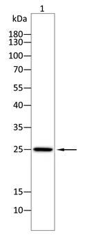 GSTM1 Antibody