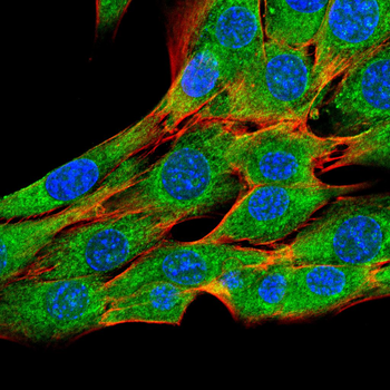 ALPL Antibody