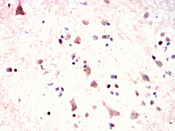 GRIA2 Antibody