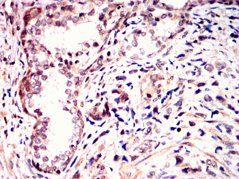 ANXA1 Antibody