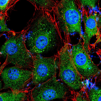 GUCY1A1 Antibody