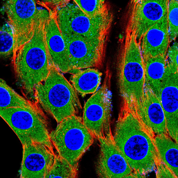 ITGB4 Antibody