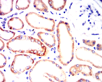 HAS2 Antibody
