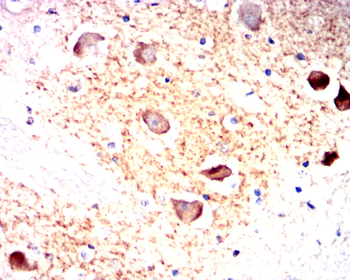HK2 Antibody
