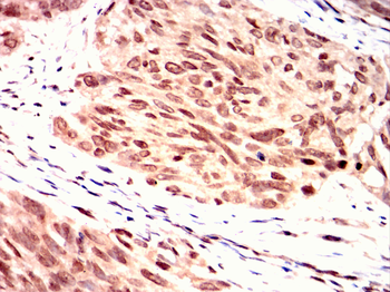 BLNK Antibody